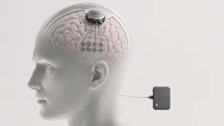 China desbanca a Elon Musk y aprueba el primer implante comercial de chip cerebral del mundo
