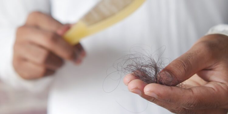 Medicamento popular en todo el mundo está relacionado con la caída del cabello, revela un nuevo estudio