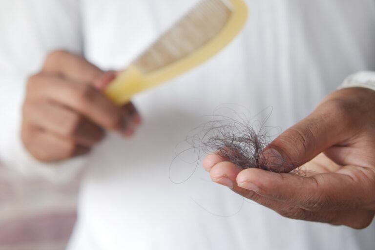 Medicamento popular en todo el mundo está relacionado con la caída del cabello, revela un nuevo estudio