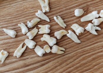 Mientras un adulto tiene 32 dientes, un tiburón puede tener 300, este dinosaurio tenía 500 y una boca impresionante