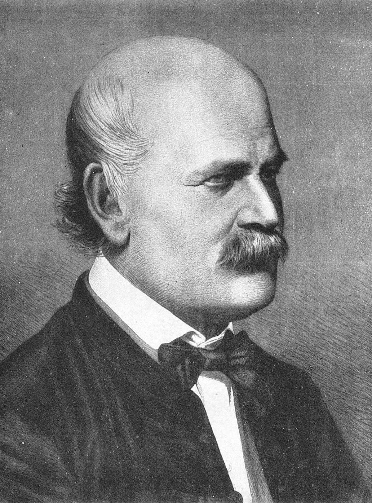Semmelweis descubrió la importancia del lavado de manos.